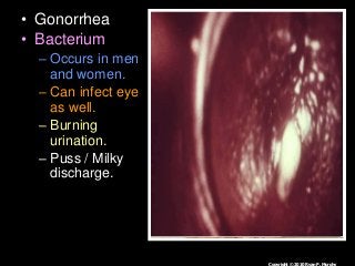 Immune System Lesson PowerPoint