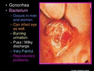 Immune System Lesson PowerPoint