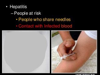 Immune System Lesson PowerPoint