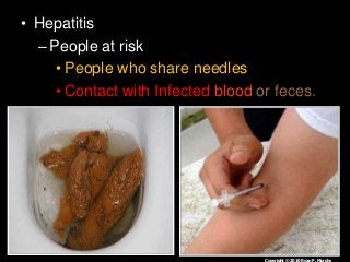 Immune System Lesson PowerPoint