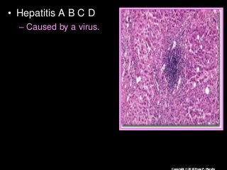 Immune System Lesson PowerPoint