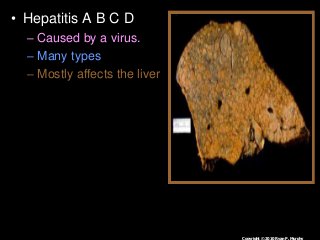 Immune System Lesson PowerPoint