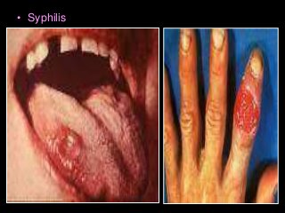 Immune System Lesson PowerPoint