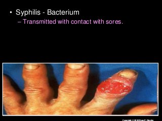 Immune System Lesson PowerPoint