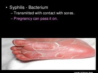 Immune System Lesson PowerPoint