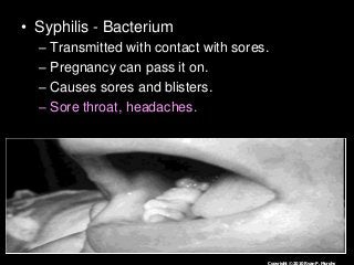 Immune System Lesson PowerPoint