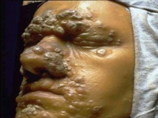 Immune System Lesson PowerPoint