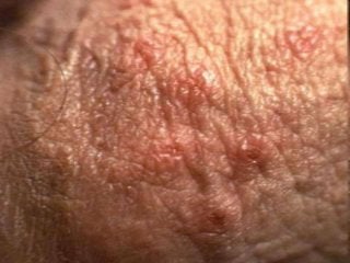 Immune System Lesson PowerPoint