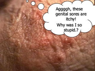 Immune System Lesson PowerPoint