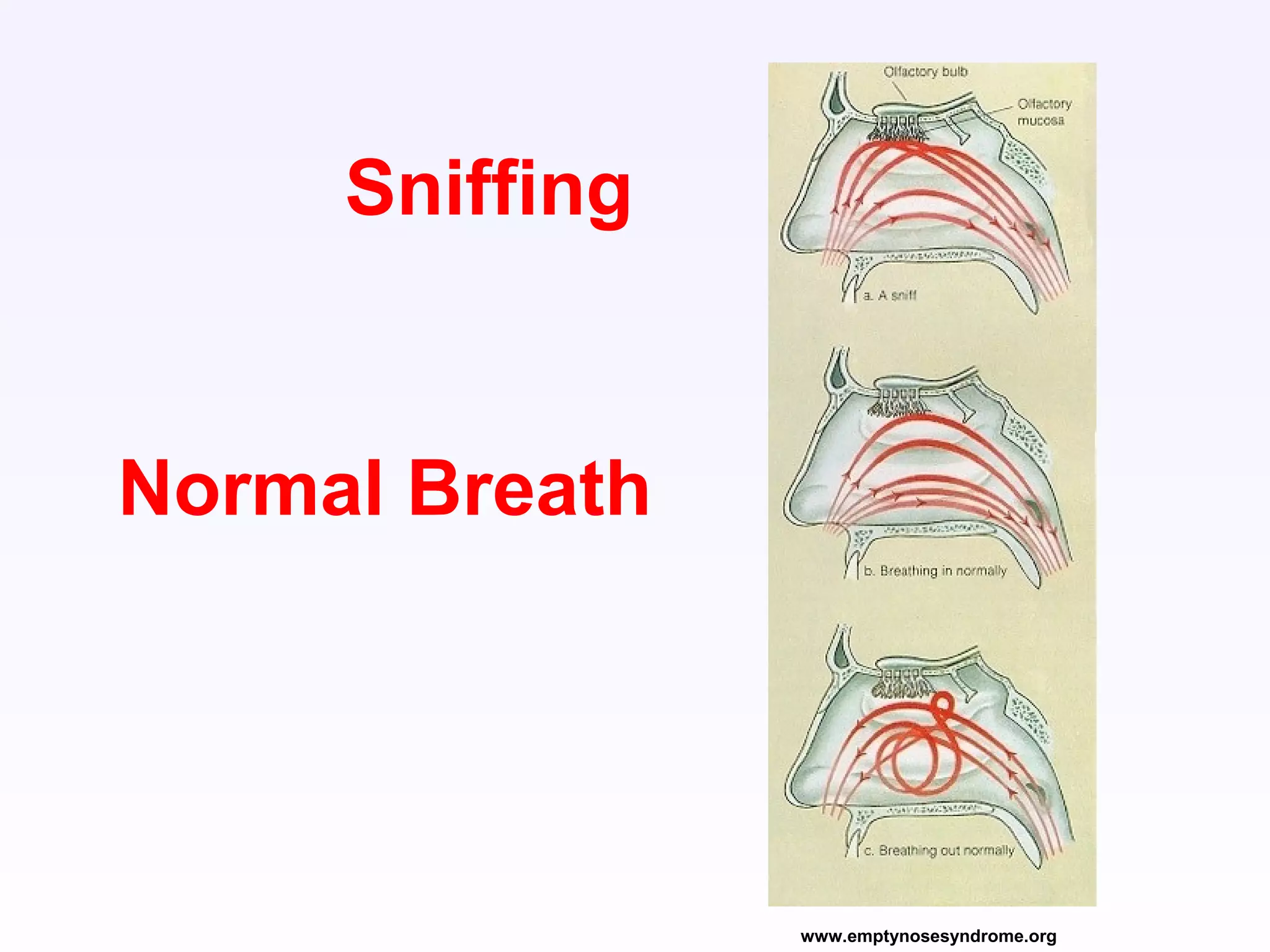 www.emptynosesyndrome.org
Sniffing
Normal Breath
 