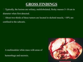 GROSS FINDINGS
Typically, the lesions are solitary, multilobulated, fleshy masses 5–10 cm in
diameter when first detected.
About two-thirds of these tumors are located in skeletal muscle, <10% are
confined to the subcutis.
A multinodular white mass with areas of
hemorrhage and necrosis.
 