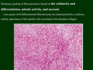 Histologic grading of fibrosarcomas is based on the cellularity and
differentiation, mitotic activity, and necrosis
Low-grade (well differentiated) fibrosarcomas are characterized by a uniform,
orderly appearance of the spindle cells associated with abundant collagen
 