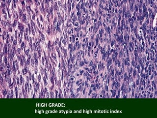 HIGH GRADE:
high grade atypia and high mitotic index
 