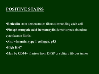 POSITIVE STAINS
•Reticulin stain demonstrates fibers surrounding each cell
•Phosphotungstic acid-hematoxylin demonstrates abundant
cytoplasmic fibrils
•Also vimentin, type 1 collagen, p53
•High Ki67
•May be CD34+ if arises from DFSP or solitary fibrous tumor
 