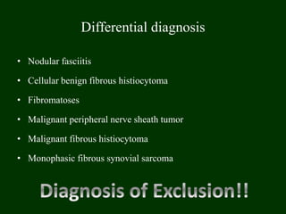 Differential diagnosis
• Nodular fasciitis
• Cellular benign fibrous histiocytoma
• Fibromatoses
• Malignant peripheral nerve sheath tumor
• Malignant fibrous histiocytoma
• Monophasic fibrous synovial sarcoma
 