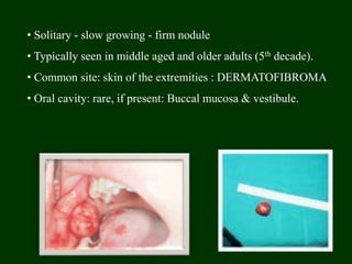 • Solitary - slow growing - firm nodule
• Typically seen in middle aged and older adults (5th decade).
• Common site: skin of the extremities : DERMATOFIBROMA
• Oral cavity: rare, if present: Buccal mucosa & vestibule.
 