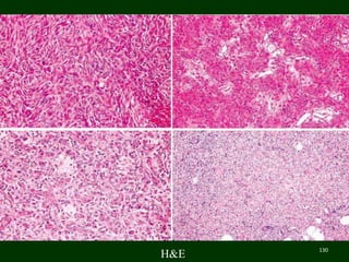 H&E
4x
10x
40x
10x
130
 