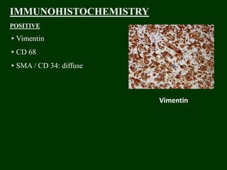 IMMUNOHISTOCHEMISTRY
POSITIVE
▸Vimentin
▸CD 68
▸SMA / CD 34: diffuse
Vimentin
 
