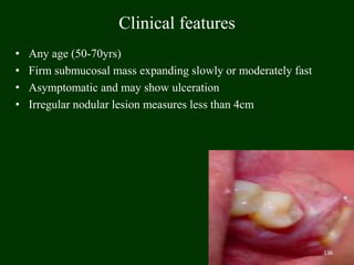 Clinical features
• Any age (50-70yrs)
• Firm submucosal mass expanding slowly or moderately fast
• Asymptomatic and may show ulceration
• Irregular nodular lesion measures less than 4cm
136
 