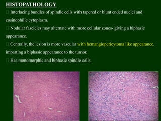 HISTOPATHOLOGY
Interlacing bundles of spindle cells with tapered or blunt ended nuclei and
eosinophilic cytoplasm.
Nodular fascicles may alternate with more cellular zones- giving a biphasic
appearance.
Centrally, the lesion is more vascular with hemangiopericytoma like appearance.
imparting a biphasic appearance to the tumor.
Has monomorphic and biphasic spindle cells
 