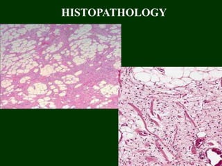 HISTOPATHOLOGY
186
 