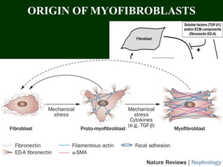 ORIGIN OF MYOFIBROBLASTS
20
 