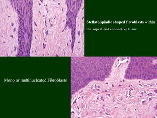 Mono or multinucleated Fibroblasts
Stellate/spindle shaped fibroblasts within
the superficial connective tissue
 