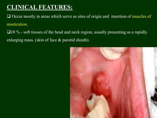 CLINICAL FEATURES:
 Occur mostly in areas which serve as sites of origin and insertion of muscles of
mastication.
10 % - soft tissues of the head and neck region, usually presenting as a rapidly
enlarging mass. (skin of face & parotid sheath).
 