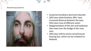 Waardenburg Syndrome
• Austomal hereditary dominant disorder
• 20% have white forelock, 99% have
increased distance between the eyes,
45% have irises of different colors
• Depigmentation of the skin and eyebrows
that meet over the bridge of the nose
area
• 50% have mild to severe sensorineural
hearing loss, which can be unilateral or
bilateral.
 