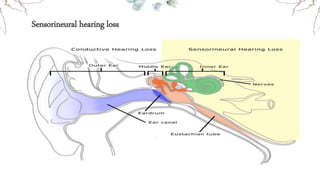 Sensorineural hearing loss
 