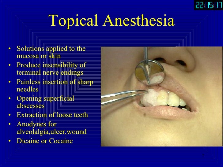 Part2.Anesthesia