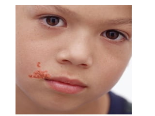 Unclear Kin On Face Part 2 skin disorders lecture-pictures(kirin) | PPT