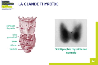 LA GLANDE THYROÏDE
Scintigraphie thyroïdienne
normale
trachée
isthme
lobes
lobe
pyramidal
cartilage
thyroïde
 