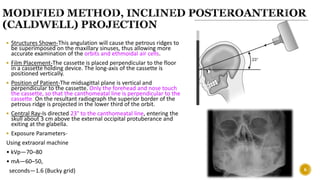 Petrous Ridge Positioning Chart Radiographic Techniques in Pediatric Dentistry - Part Two....... | PPTX