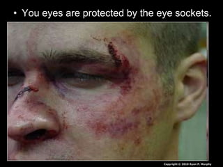 • You eyes are protected by the eye sockets.
Copyright © 2010 Ryan P. Murphy
 
