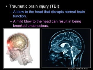 • Traumatic brain injury (TBI)
– A blow to the head that disrupts normal brain
function.
– A mild blow to the head can result in being
knocked unconscious.
Copyright © 2010 Ryan P. Murphy
 
