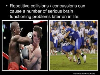 • Repetitive collisions / concussions can
cause a number of serious brain
functioning problems later on in life.
Copyright © 2010 Ryan P. Murphy
 