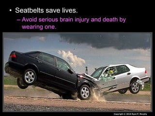 • Seatbelts save lives.
– Avoid serious brain injury and death by
wearing one.
Copyright © 2010 Ryan P. Murphy
 