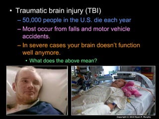• Traumatic brain injury (TBI)
– 50,000 people in the U.S. die each year
– Most occur from falls and motor vehicle
accidents.
– In severe cases your brain doesn’t function
well anymore.
• What does the above mean?
Copyright © 2010 Ryan P. Murphy
 