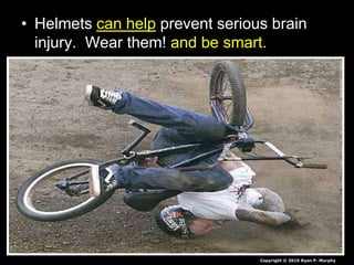 • Helmets can help prevent serious brain
injury. Wear them! and be smart.
Copyright © 2010 Ryan P. Murphy
 