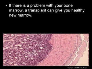 • If there is a problem with your bone
marrow, a transplant can give you healthy
new marrow.
Copyright © 2010 Ryan P. Murphy
 