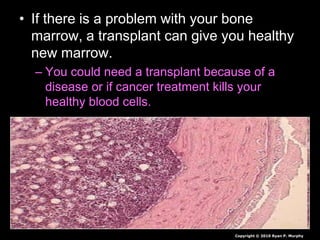 • If there is a problem with your bone
marrow, a transplant can give you healthy
new marrow.
– You could need a transplant because of a
disease or if cancer treatment kills your
healthy blood cells.
Copyright © 2010 Ryan P. Murphy
 