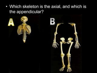 • Which skeleton is the axial, and which is
the appendicular?
 