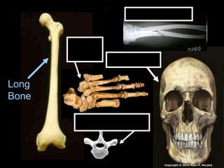 Long
Bone
Short
Bones
Irregular Bone
Flat Bones
Long Bone
Copyright © 2010 Ryan P. Murphy
 