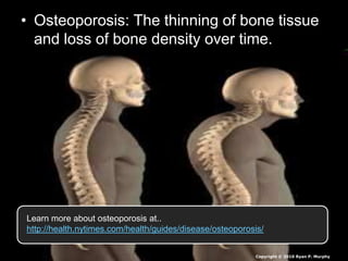 • Osteoporosis: The thinning of bone tissue
and loss of bone density over time.
Copyright © 2010 Ryan P. Murphy
Learn more about osteoporosis at..
http://health.nytimes.com/health/guides/disease/osteoporosis/
 
