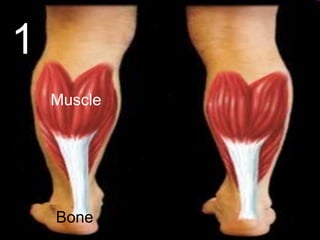 1
Muscle
Bone
 