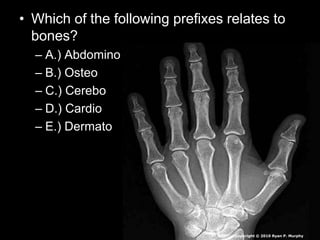 • Which of the following prefixes relates to
bones?
– A.) Abdomino
– B.) Osteo
– C.) Cerebo
– D.) Cardio
– E.) Dermato
Copyright © 2010 Ryan P. Murphy
 