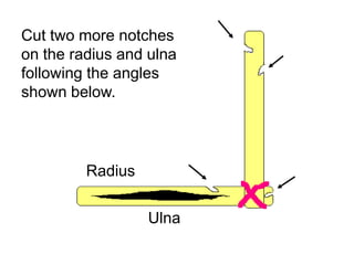 Cut two more notches
on the radius and ulna
following the angles
shown below.
Radius
Ulna
Copyright © 2010 Ryan P. Murphy
 