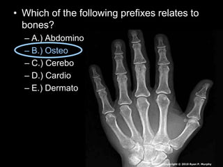 • Which of the following prefixes relates to
bones?
– A.) Abdomino
– B.) Osteo
– C.) Cerebo
– D.) Cardio
– E.) Dermato
Copyright © 2010 Ryan P. Murphy
 