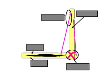 Humerus
Radius
Ulna
Ligament
Tendon
Copyright © 2010 Ryan P. Murphy
 